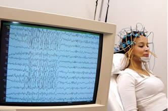 elettroencefalogramma